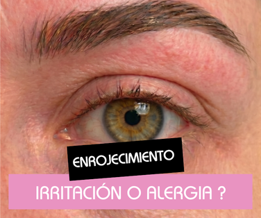 Reaccion alergica o enrojecimiento : que hacer ?
